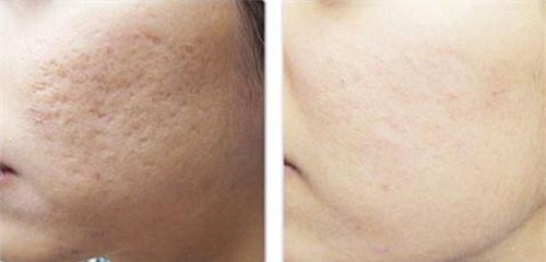 seo lom mo di trong thay chi voi 2 ngan dong rau ma - 7