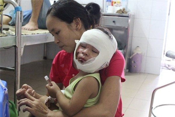 Cô nướng mực, ba cháu thành ngọn đuốc