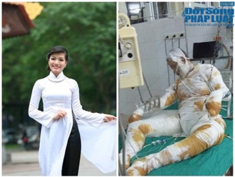 Cô gái xinh đẹp bị bỏng cồn khi nướng mực đã tử vong - Ảnh 1