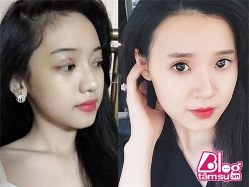 midu blogtamsuvn (2)