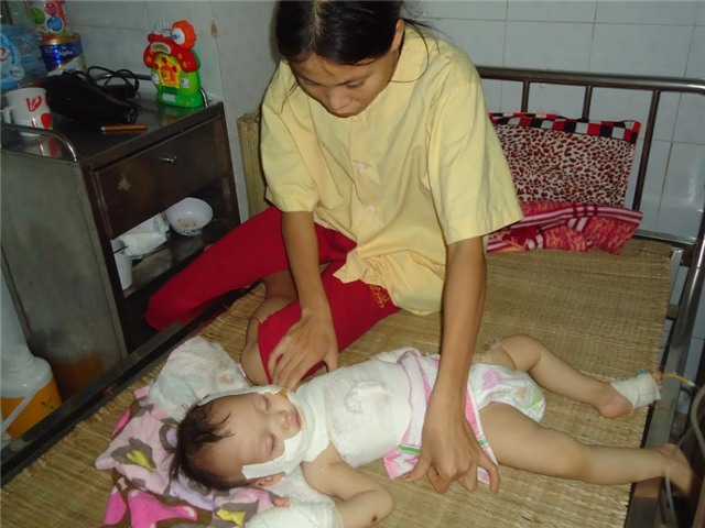 hoàn cảnh khó khăn, bệnh hiểm nghèo, viện bỏng quốc gia