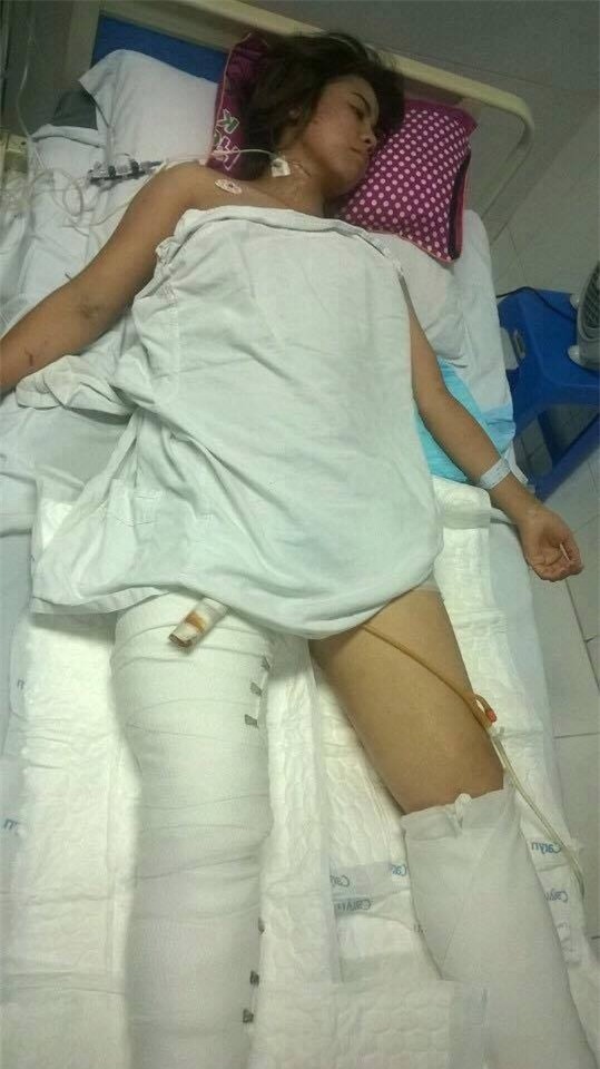 Cô gái gặp nạn trong vụ sập nhà ở Cửa Bắc có nguy cơ bị cắt chân - Ảnh 2.