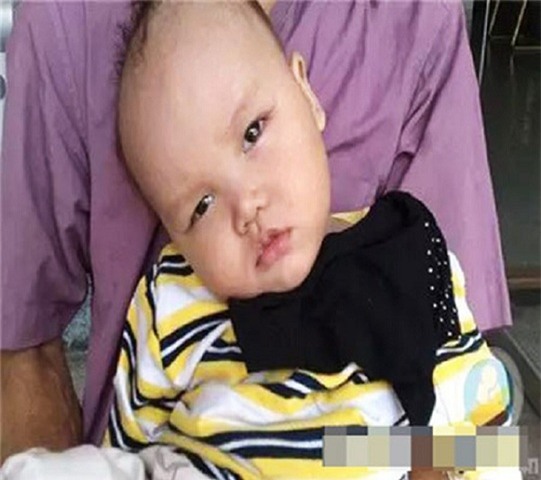 ngo_doc_bang_phien_khien_be_gai_8_thang_chao_doi