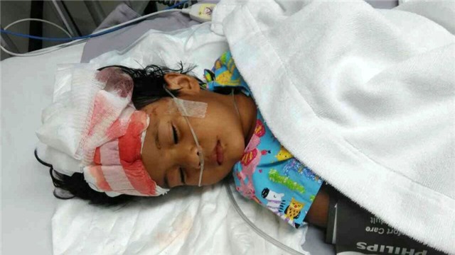 be gai 3 tuoi bi quat tran cuon dau khi duoc bo tung hung hinh anh 1