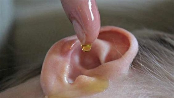 Con bị rách màng nhĩ vì mẹ dùng tăm bông lấy ráy tai cho con - Ảnh 5.