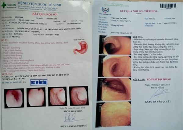 GS Hà Văn Quyết, u trực tràng, cắt khối u