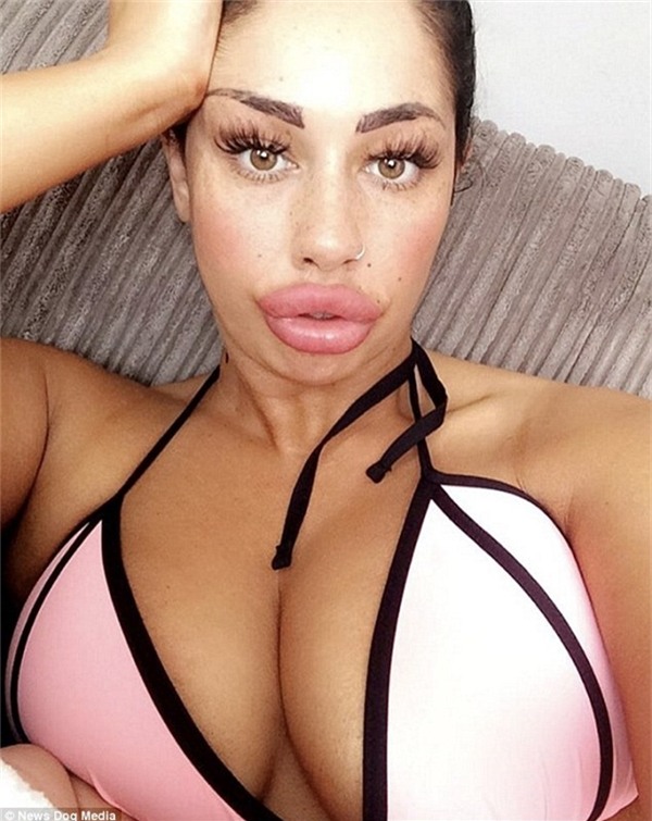 Alia Byrne tốn khoảng 58 triệu đồng để có được “bờ môi mơ ước”.(Ảnh: News Dog Media)