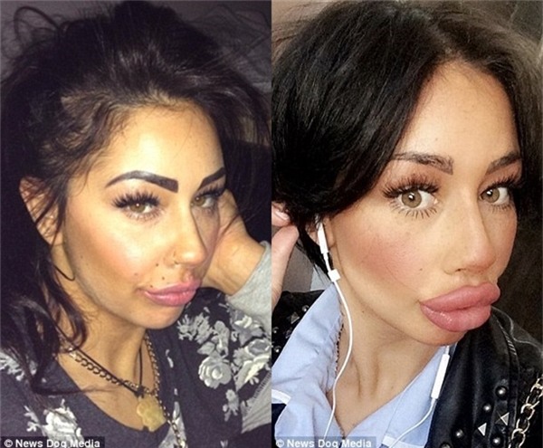 Sau một năm, Alia đã thay đổi như thế này.(Ảnh: News Dog Media)