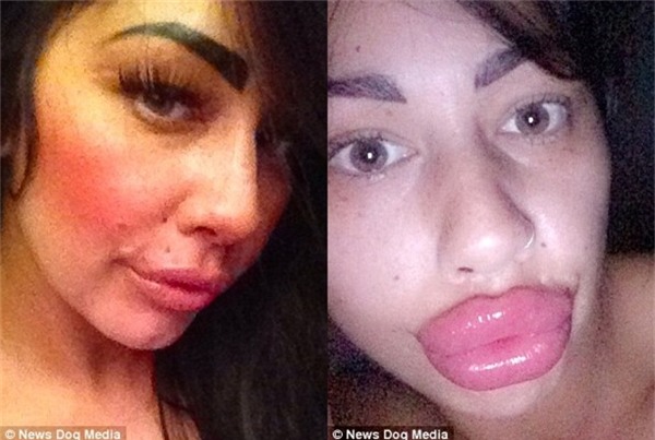 Alia từng cảm thấy “không ổn” với đôi môi cha sinh mẹ đẻ.(Ảnh: News Dog Media)