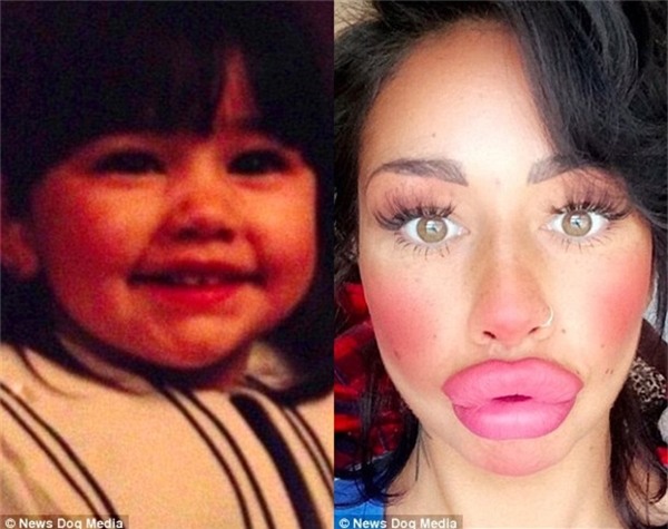 Hình ảnh lúc bé của Alia và hình ảnh hiện tại.(Ảnh: News Dog Media)