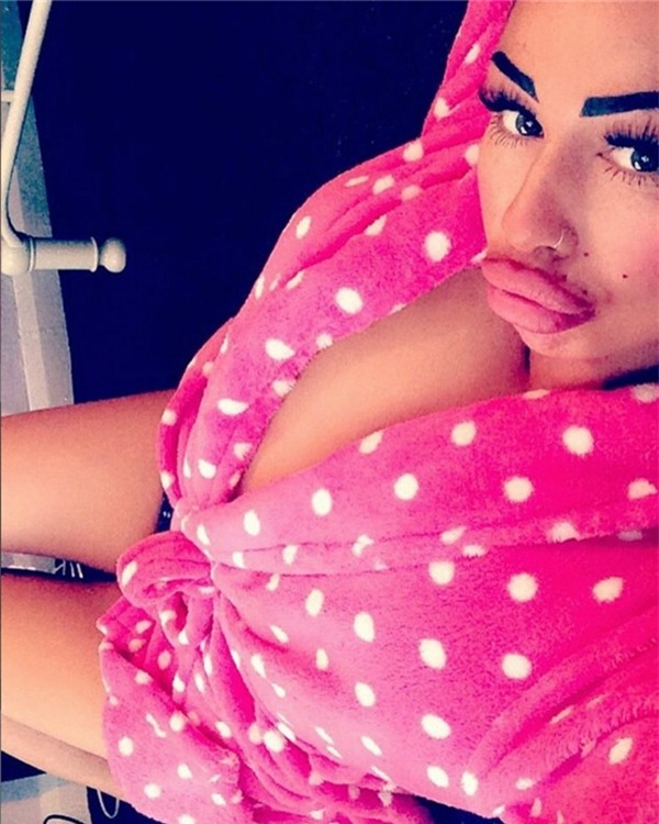 Bà mẹ đơn thân gây sốc với đôi môi “tràn trề bờ đê”