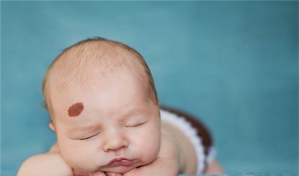 neu-co-1-trong-nhung-vet-bot-nay-dam-bao-ban-se-duoc-ca-doi-sung-suong1