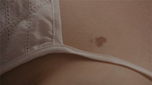 neu-co-1-trong-nhung-vet-bot-nay-dam-bao-ban-se-duoc-ca-doi-sung-suong2