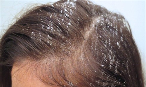 5 meo lam dep tu phan rom ban se tiec neu khong duoc biet - 2