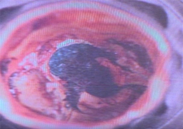 Me vu nu khoa than, thac si tro thanh ke giet nguoi hinh anh 5