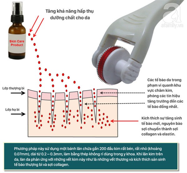 phương pháp lăn kim