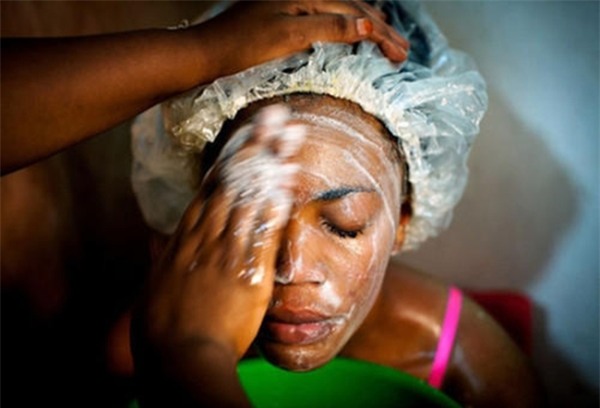 Thâm nhập vào thế giới tẩy trắng da còn kinh khủng hơn cả kem trộn của các cô gái châu Phi - Ảnh 1.