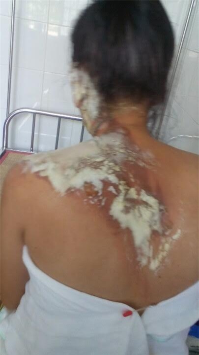 chong de vo xuong dat roi tuoi nuoc soi vao lo tai hinh anh 1