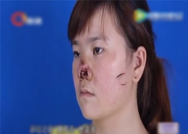 tảo hôn, bạo lực gia đình, chồng đánh đập vợ, Trung Quốc, bạo lực, gia đình