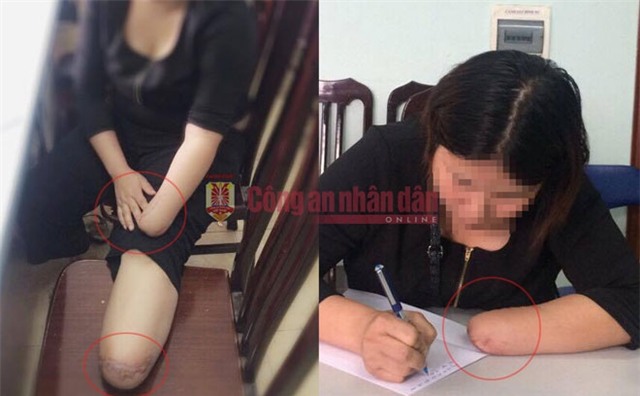 hai hung loi thu nhan thue chat chan tay de truc loi cua co gai tre hinh anh 1