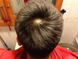 Xoáy tóc bật mí điều gì về con người bạn - Ảnh 1.