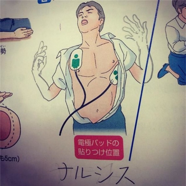 Để cho giống một người đang bất tỉnh, các thánh đã vẽ thêm đôi tay co giật cứng đờ, thật là có tâm.