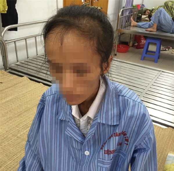 trầm cảm, trầm cảm sau sinh, mất ngủ, tâm thần, bệnh viện tâm thần