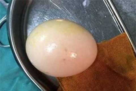 Nghịch dại, chồng nhét trứng vào “chỗ kín” của vợ - Ảnh 1