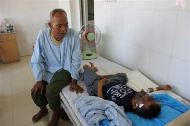 Be trai 14 tuoi nga vao bep lua, hong hoan toan mot ben mat