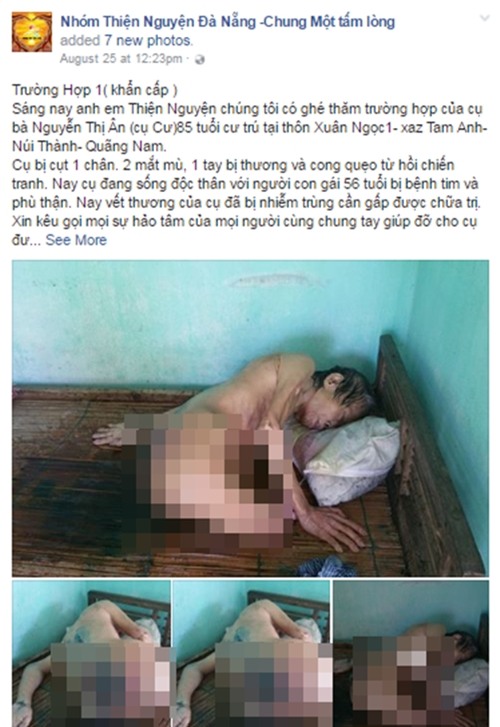 Cộng đồng kêu gọi giúp đỡ cụ bà mù, cụt chân đang thoi thóp vì vết thương lở loét - Ảnh 1.