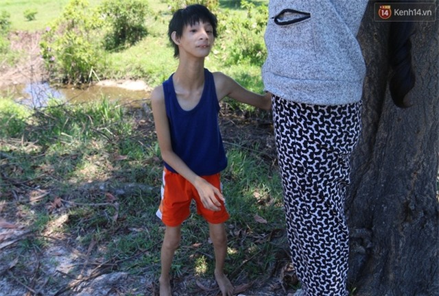 Cuộc sống cùng cực của cậu bé người khỉ 14 tuổi nhưng chỉ cao 0,8 mét, nặng 7kg ở Huế - Ảnh 1.