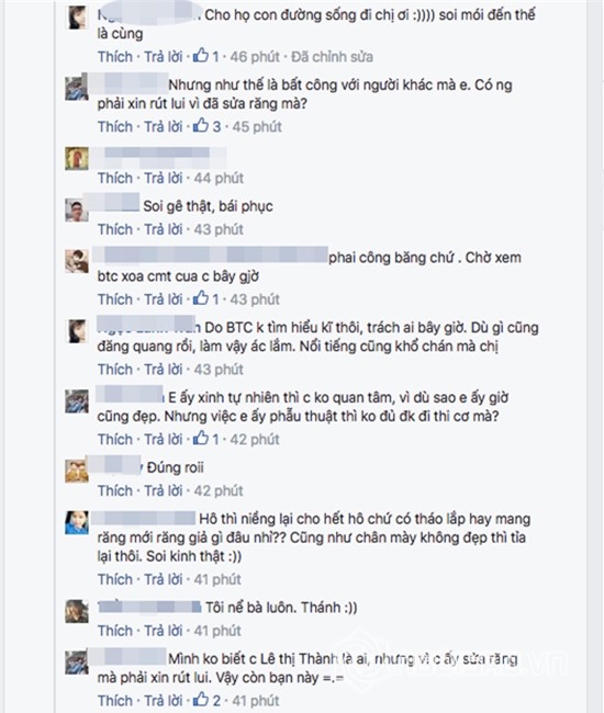 Hoa hậu Việt Nam dính nghi án phẫu thuật răng 0