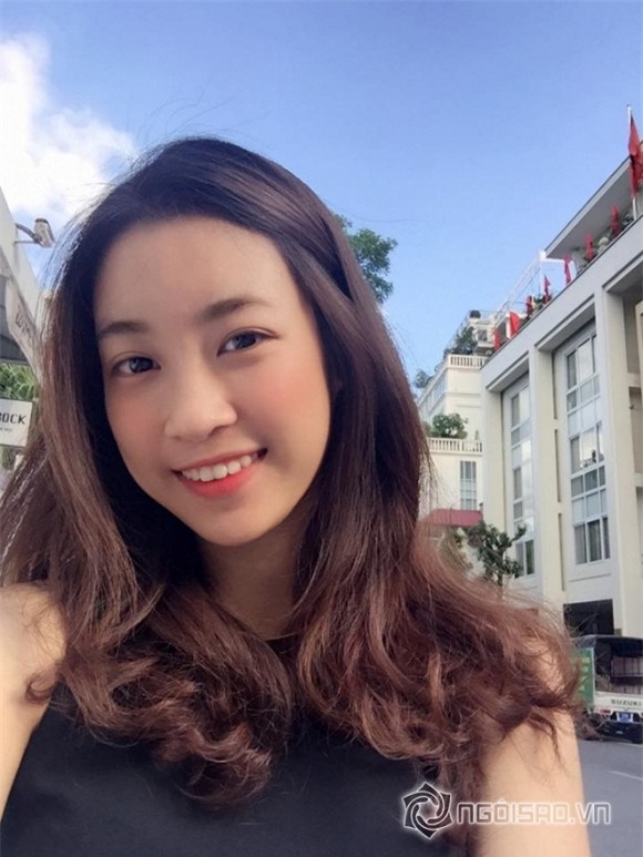 Hoa hậu Việt Nam dính nghi án phẫu thuật răng 3