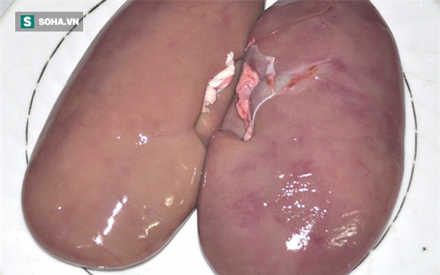 7 món ăn hấp dẫn nhưng lại chứa nhiều nguy cơ gây hại sức khỏe - Ảnh 1.