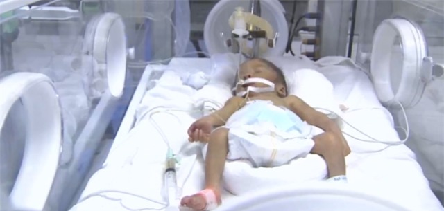 Thieu uy tu choi dieu tri ung thu de cuu con: Chau be hoi sinh than ky