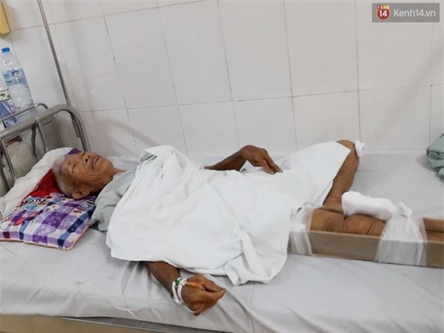 Vụ tài xế cán cụ ông gãy chân rồi bỏ chạy: Tôi nằm nửa tiếng ngoài đường, chậm 10 phút là chết - Ảnh 1.