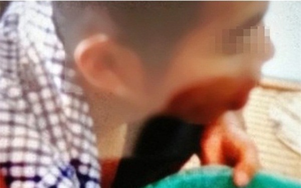 Thực hư chuyện đổ thuốc diệt cỏ vào miệng con nợ ở Hải Phòng