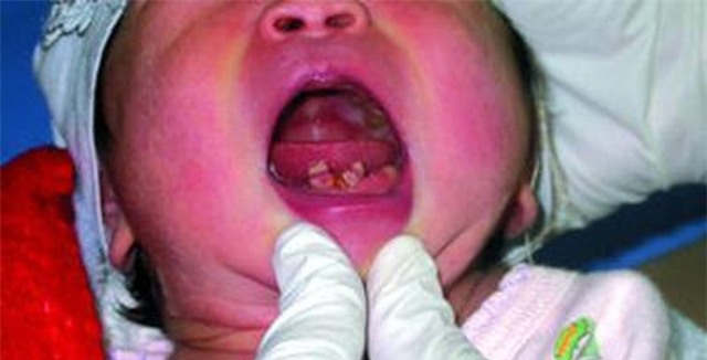 Trẻ sơ sinh vừa khóc chào đời đã khiến bác sĩ 