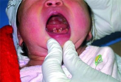 Trẻ sơ sinh vừa khóc chào đời đã khiến bác sĩ giật mình vì... - Ảnh 2.