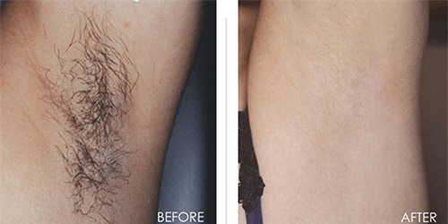 bat ngo vi cong dung triet long khong dau khong rat cua nuoc chanh - 6