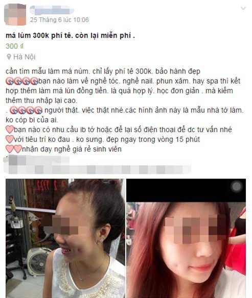 Mặt sưng vù vì làm má lúm đồng tiền giá rẻ - Ảnh 2.