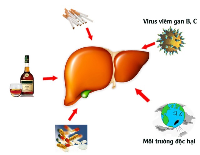 Những giải pháp bảo vệ gan hiệu quả bạn nên làm theo - Ảnh 1.