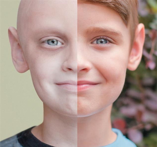 Tại sao số lượng nam giới chết vì ung thư lại nhiều hơn nữ giới? - Ảnh 2.