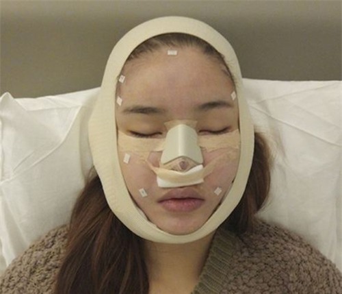 loat sao viet khien fan khong the nhan ra vi guong mat bong nhien khac la - 16