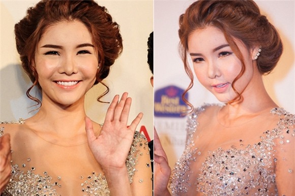 Mỹ nhân Việt mặt sưng vù  1