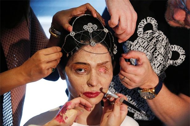 Cô gái với gương mặt biến dạng vì axit tự tin sải bước trên sàn catwalk tại Tuần lễ Thời trang New York - Ảnh 3.