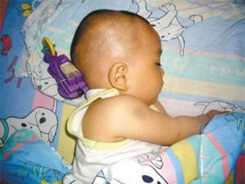 be 11 thang bi do choi cam vao nao, phan ung cua nguoi me khien bac si tam tac - 1