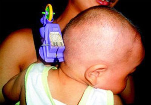 be 11 thang bi do choi cam vao nao, phan ung cua nguoi me khien bac si tam tac - 2