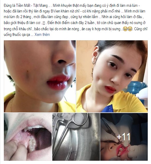 cô gái trẻ thẩm mỹ má lúm bị hỏng