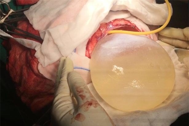 kinh hoang nang san day chiem nua nao co be an do hinh anh 1